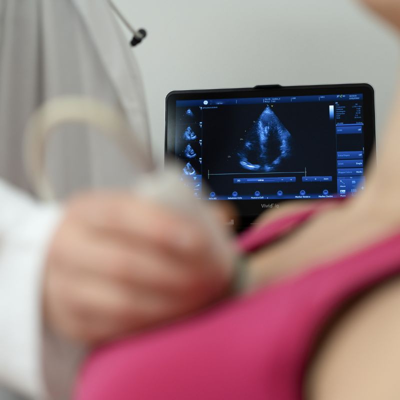 Ecocardiogramma Civita Castella Innova Smart CLinic